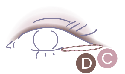 STEP3 CとDを目尻に重ねる図解