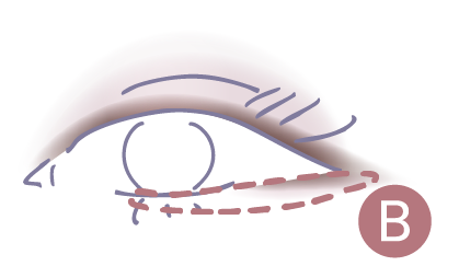 STEP4 Bを目尻から2/3程度いれる図解