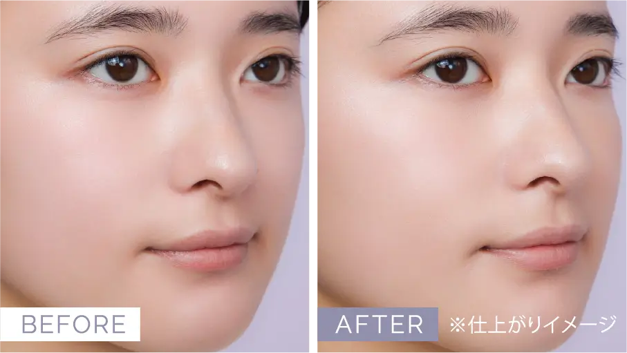 FIX FOUNDATION 使用前後の比較