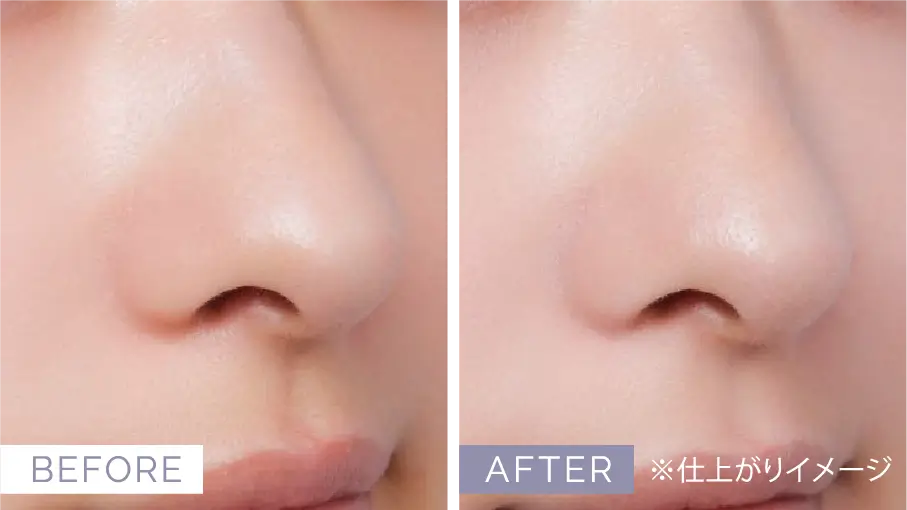 SKIN FILM PORE BASE 使用前後の比較 毛穴カバー